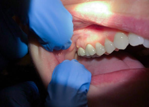 Best Emergency Cosmetic Dentistry in Cedar Knolls, NJ